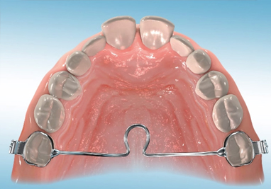 Stanley Orthodontics Describes Orthodontic Appliances
