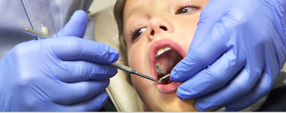 How old do you need to be to get braces?